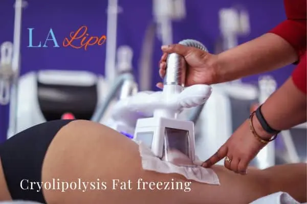 women getting fat freezing Isleworth