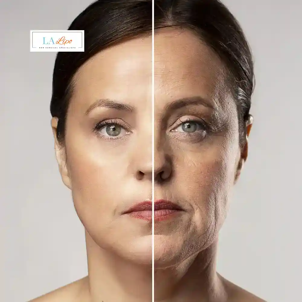 How Can You Tell If Non-Surgical Skin Tightening Is Right for You Isleworth?