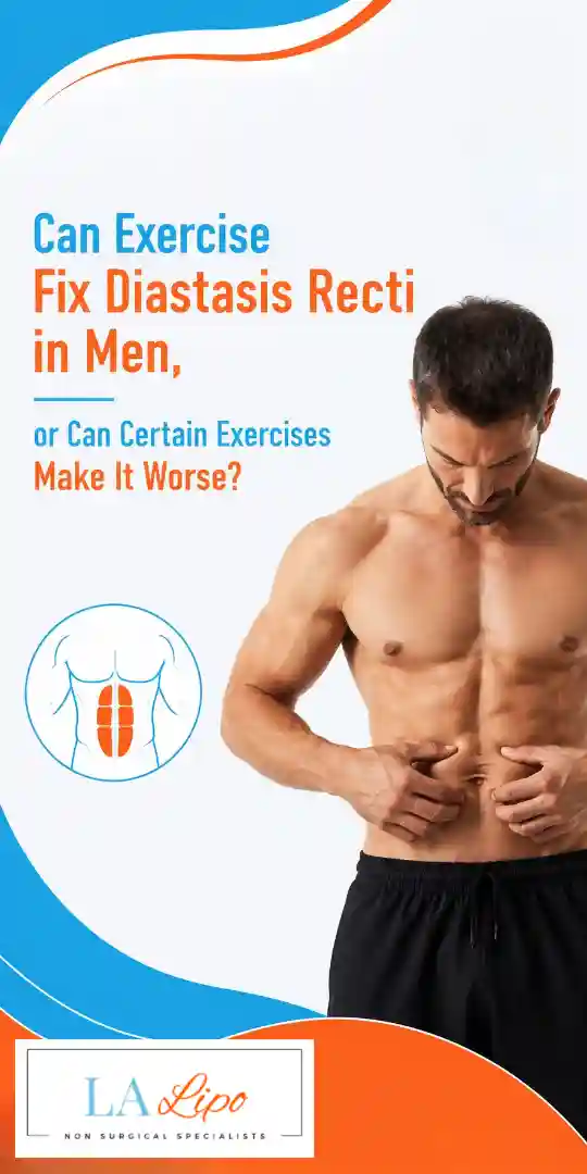 Can Exercise Fix Diastasis Recti in Men, or Can Certain Exercises Make It Worse Isleworth?